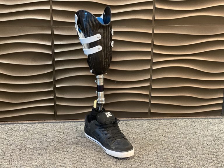 MARTIN BIONICS: SOCKETLESS SOCKET | Innovative Prosthetic Solutions, Inc.